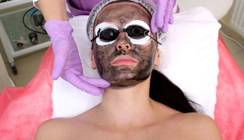 Carbon laser Peel treatment